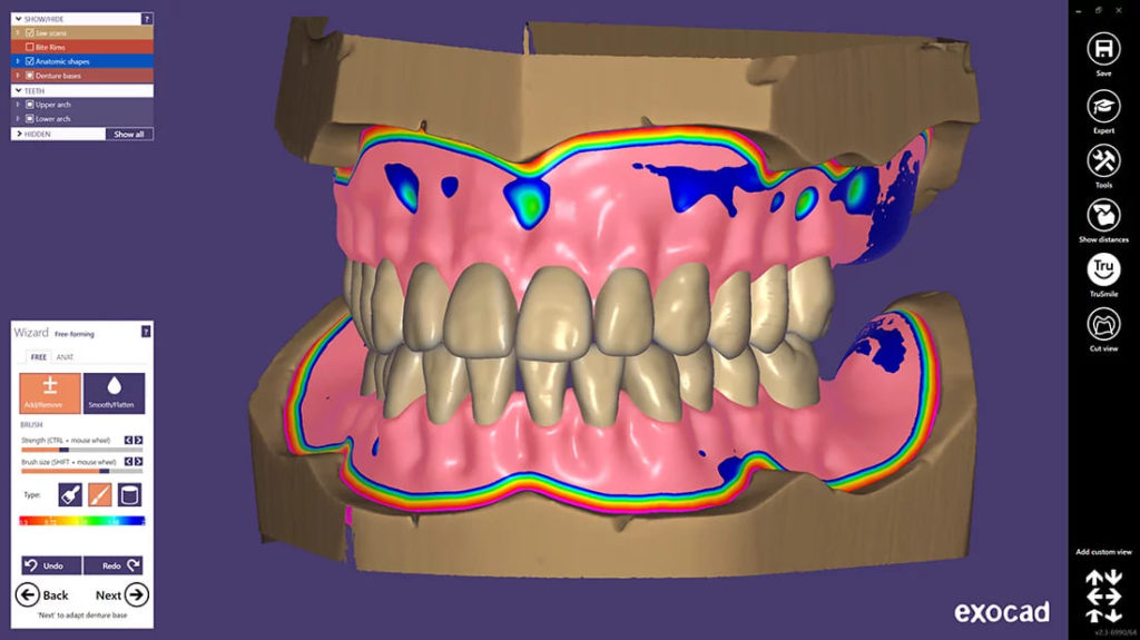 Моделирование exocad