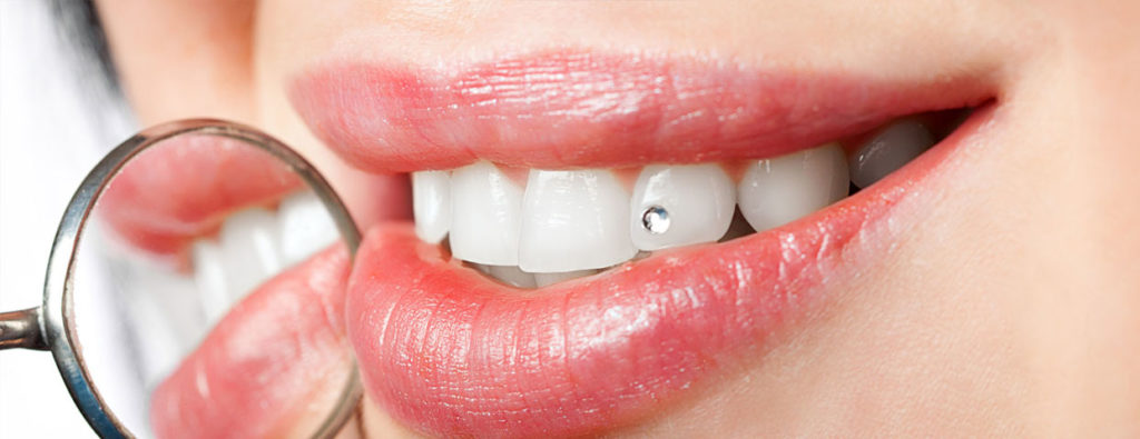 Стоматологические скайсы