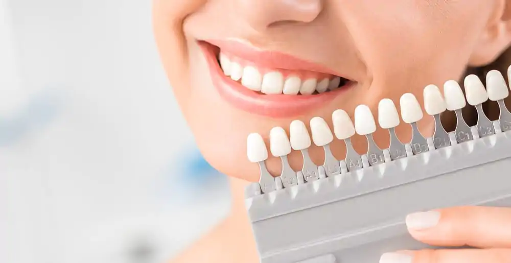 Восстановление зубов