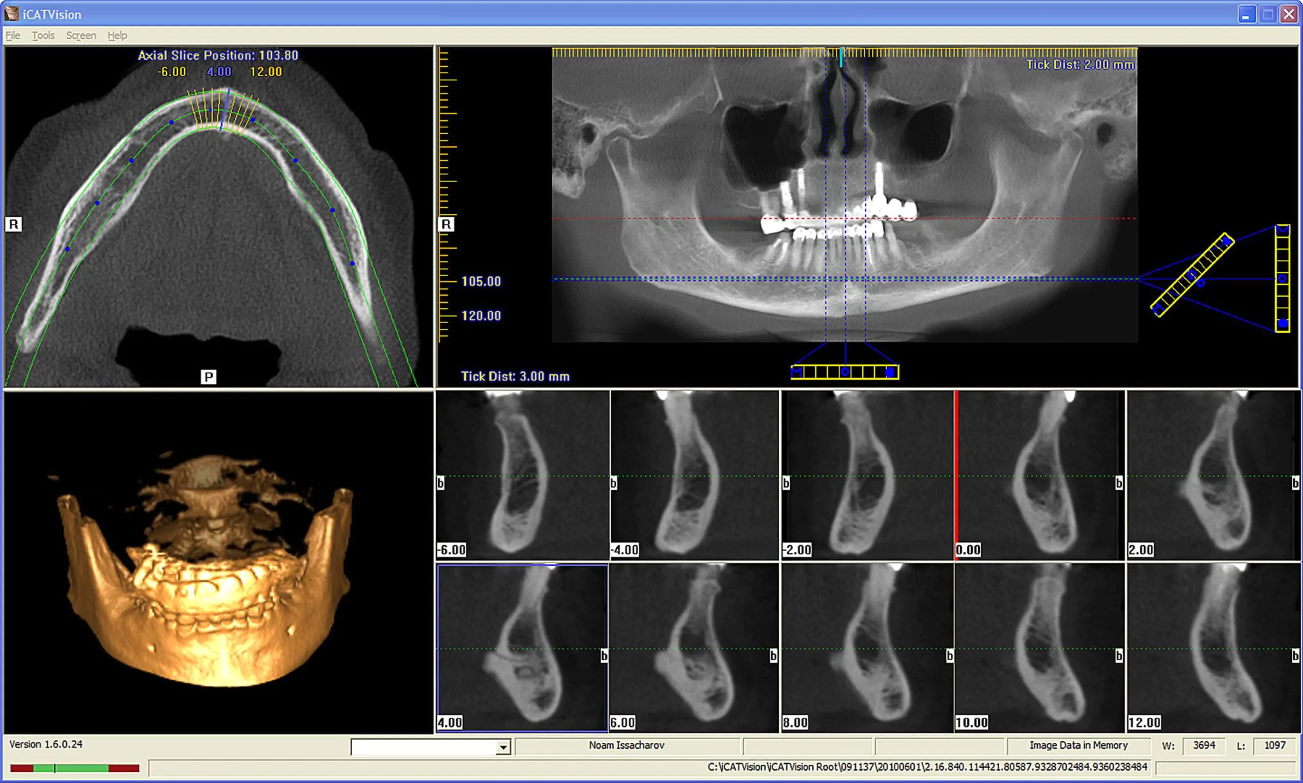 3d-kt-scan