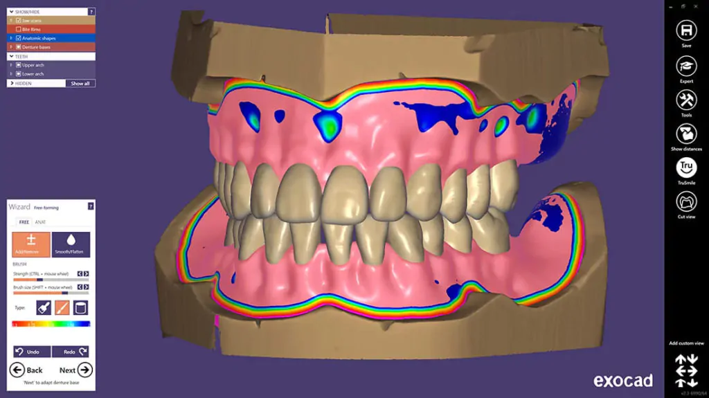 Моделирование exocad