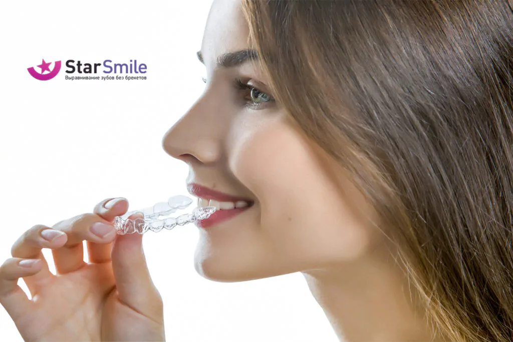 Производитель элайнеров Star Smile (Стар Смайл) Производитель элайнеров Star Smile (Стар Смайл)
