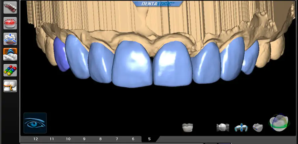 Программа CAD/CAM для изготовления культевых вкладок Программа для изготовления культевых вкладок по методике CAD/CAM