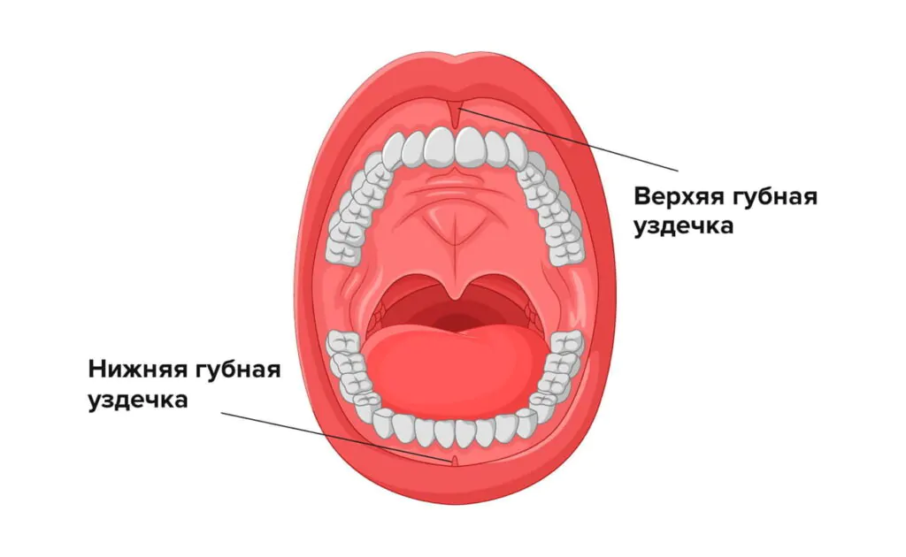 Иллюстрация губной уздечки Губная уздечка на примере иллюстрации ротовой полости