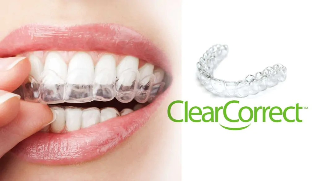 Производитель элайнеров Clear Correct (Клир Коррект) Производитель элайнеров Clear Correct (Клир Коррект)